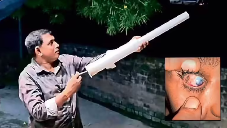 इंस्टाग्राम के वायरल ‘कार्बाइड गन’ ट्रेंड ने मप्र से बिहार तक छीन लीं बच्चों की आंखों की रोशनी