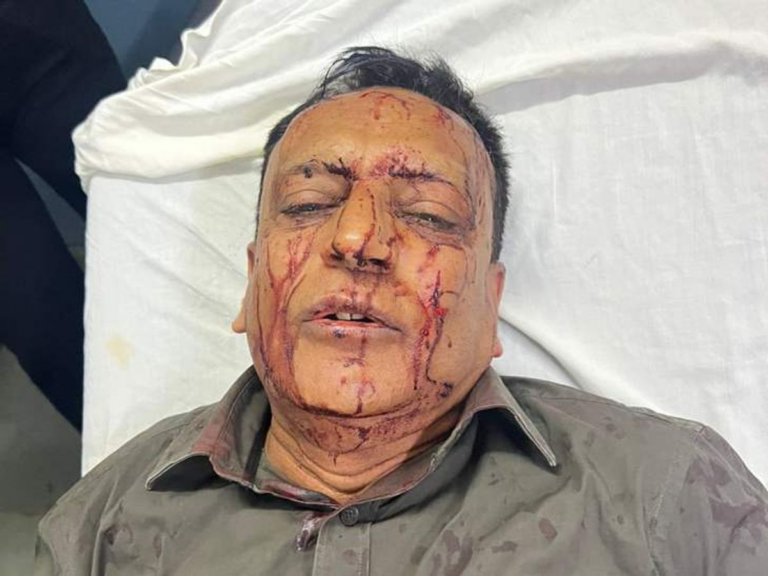 इंदौर में सिरफिरे ने कार में दंपति को बनाया बंधक:अंगूठी,घड़ी, मोबाइल और रुपए छीने, लोगों ने पुलिस को सौंपा